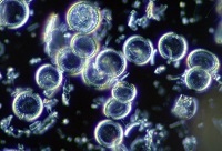 珪藻土を削り取って顕微鏡で観察したところ