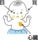 風しんで影響が出る胎児の部位：目・耳・心臓