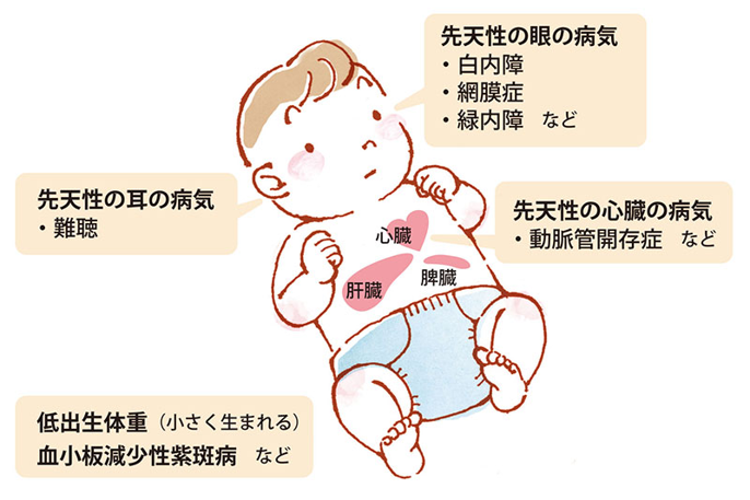 fuushin-CRS